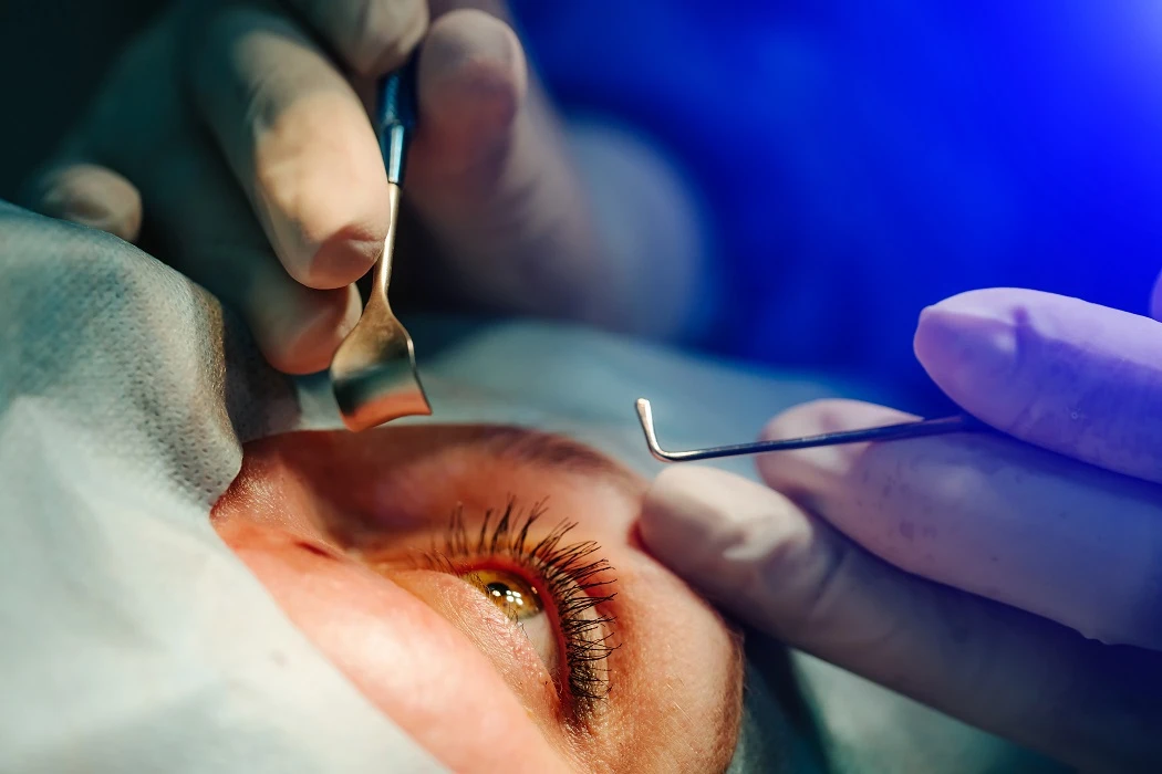 what are the pros and cons of cataract surgery